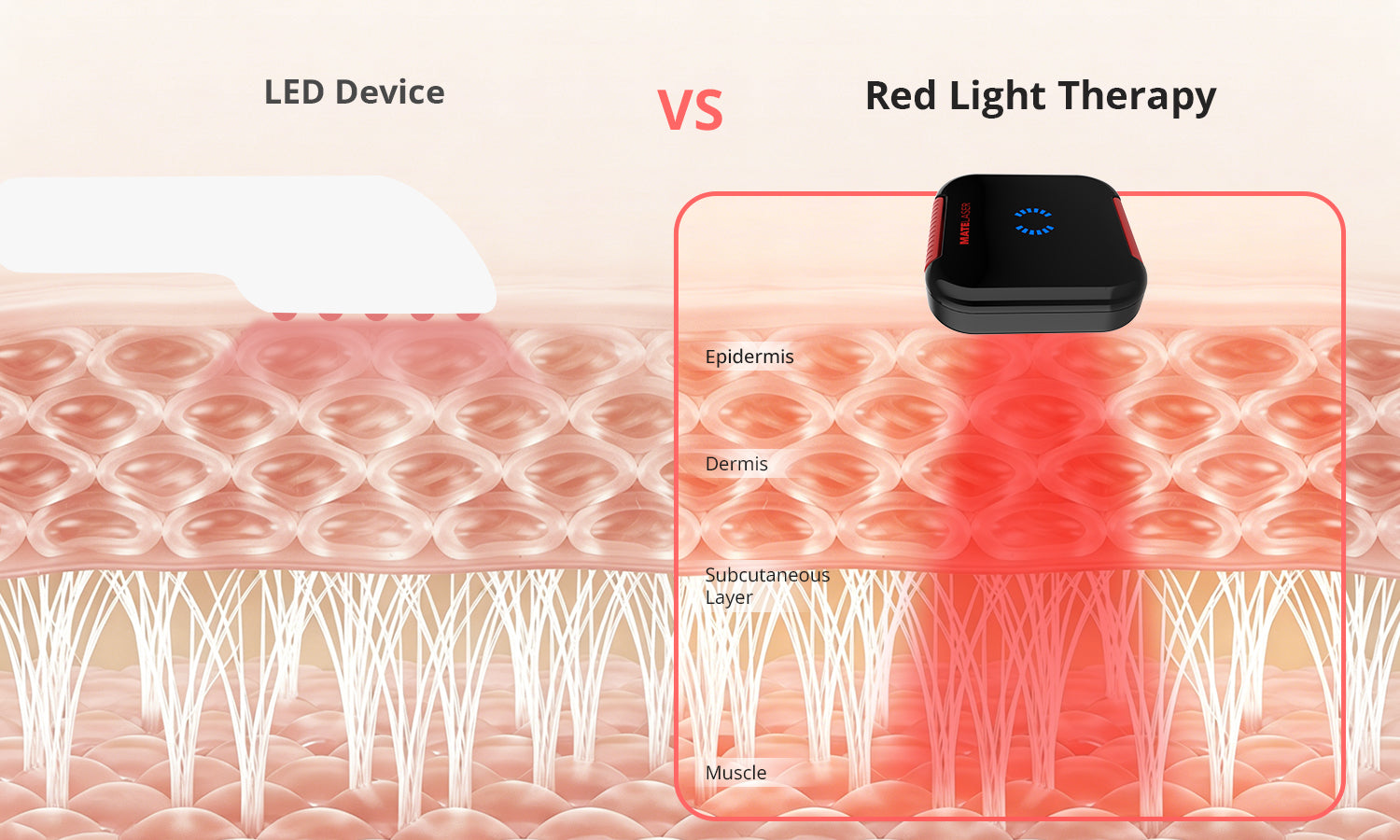 Stop Wasting Money on Weak LED Devices — Experience Real Red Light Therapy Power