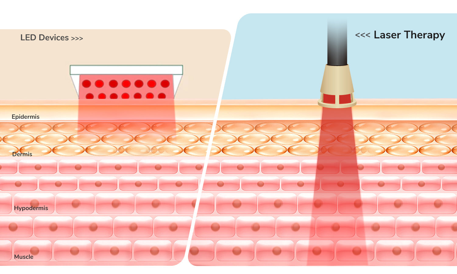 Laser Therapy vs LED Devices: Which Delivers Real Pain Relief Results?