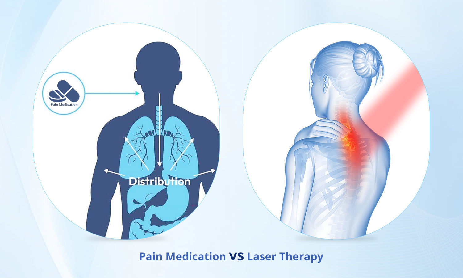 Laser Therapy vs Pain Medication: Why More People Are Choosing Light-Based Healing in 2026