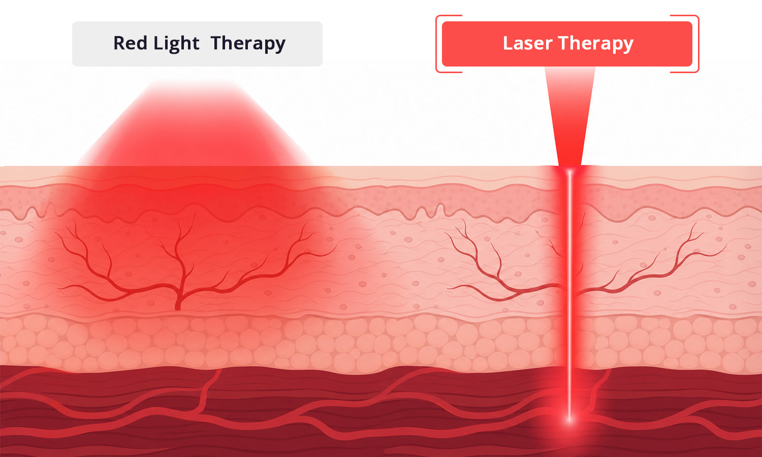 Red Light Therapy vs Laser Therapy for Pain Relief: Which Technology Delivers Deeper Healing?
