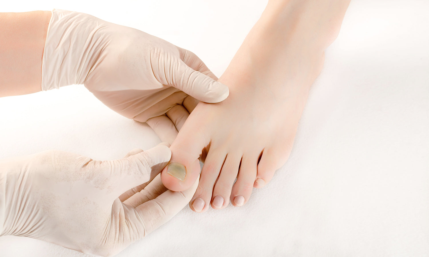 Class IV Laser Therapy for Toenail Fungus
