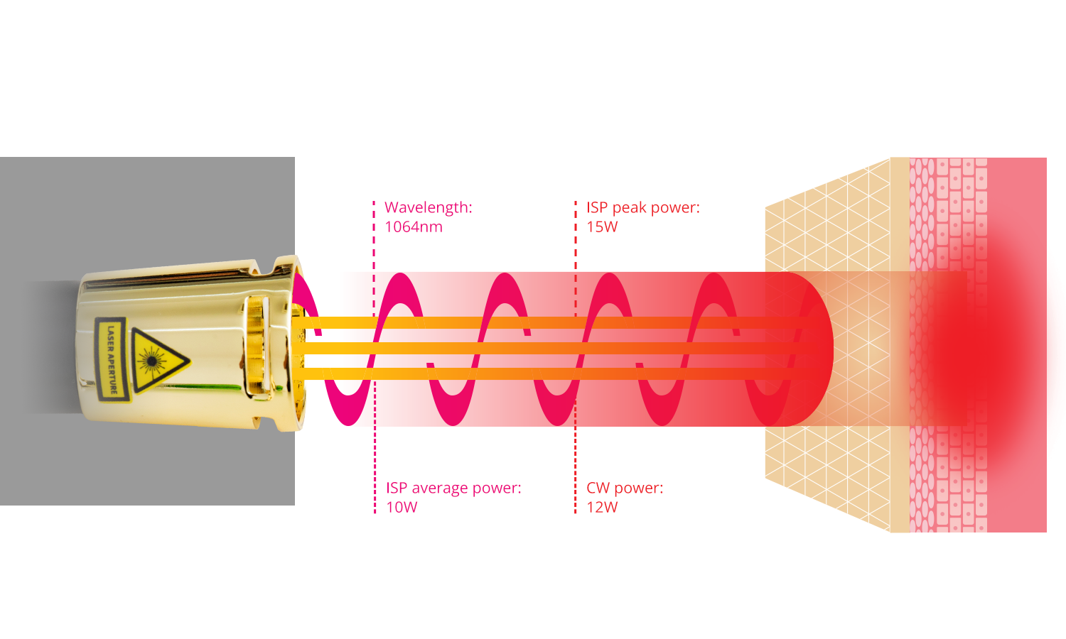 The Remarkable Healing Power of MATELASER Laser Therapy