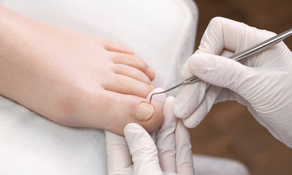 Toenail Fungus Won’t Go Away? How Laser Therapy Is Changing the Future of Fungal Nail Treatment